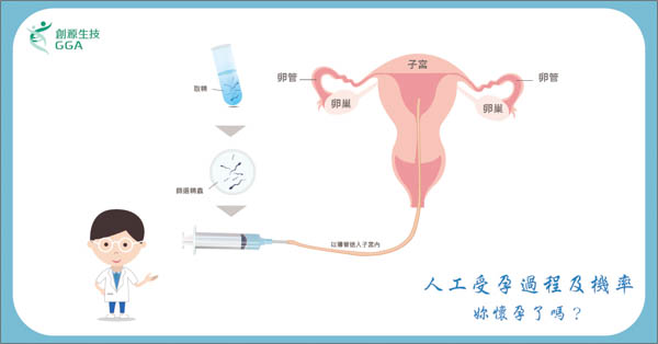 人工受孕過程及機率 妳懷孕了嗎？ 創源生技基因檢測公司 基因醫學、數位科技、精準健康推薦專業品牌 
